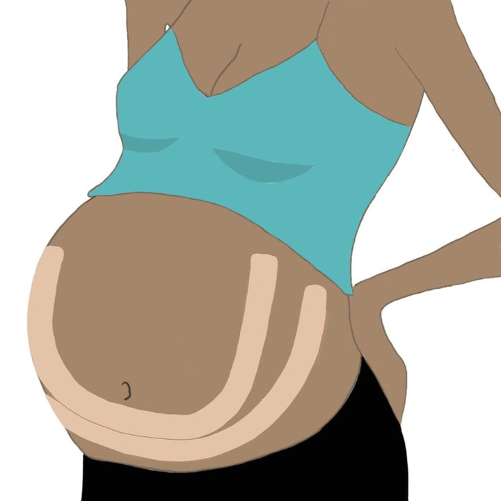 Fødebagen | Støttetape | Torgunns Barneklær AS